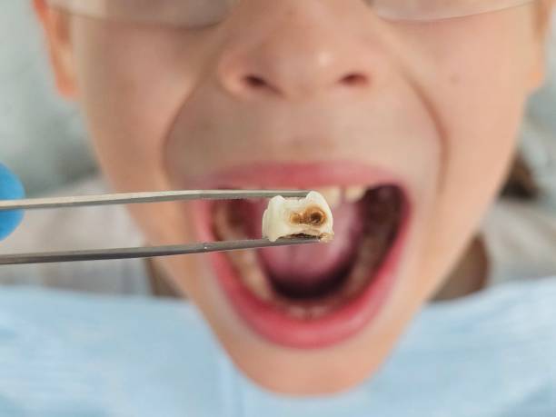 Best Emergency Pediatric Dentist  in Irvington, NY